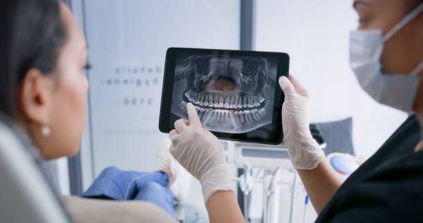 Licensed Wisdom Tooth Removal service in South Portland, ME - Smile Center Dentistry